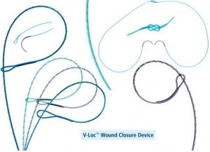 Medtronic - V-Loc 180 Wound Closure Device - Vlocl0644 - Absorbable Suture With Needle Polyglyconate 20 1/2 Circle Taper Point Size 3 - 0 Barbed Monofilament