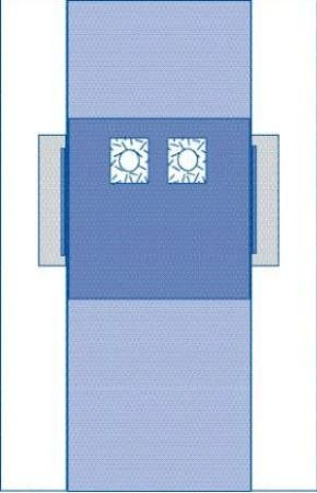 Medline - Dynjp4114 - Drape,Femoral Angiography,Pouch,St - Case/10