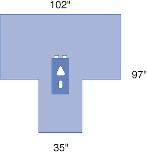 Medline - Dynjp9100 - Pack,Laparoscopy,W/O Gown - Case/10