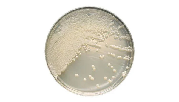 Bd Becton Dickinson - Bbl - 221278 - Media, Sabouraud Dextrose Agar - Package/100