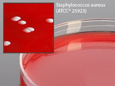 Hardy Diagnostics - A93 - Plates Agar Pea 10/Bx         15X100Mm W/5% Sheep Blood D/S - BX/10