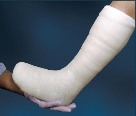 Bsn Medical - Cutimed - 7800900 - Off - Loader Tcc System (Plaster & Fiberglass)