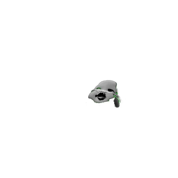 Sun Med - Salter-Style - 1615-7-50 - Etco2 Nasal Sampling Cannula With O2 Delivery Micro Flow Pediatric Curved Prong / Nonflared Tip