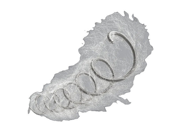 Cook Medical - Nester - G47325 - Embolization Coil