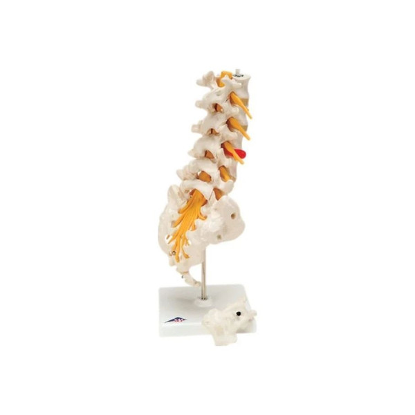 Fabrication Enterprises - Baseline - 12-4543 - Anatomical Model - Lumbar Spinal Column With Dorso - Lateral Prolapsed Disc