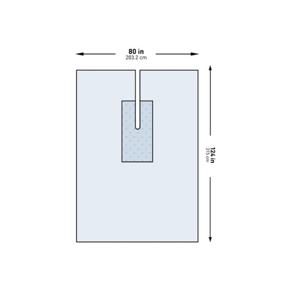 Mckesson - 183-I80-09149G-S - Orthopedic Drape U - With Split 80 W X 124 L Inch Sterile
