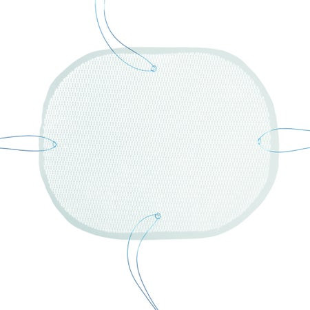 Medtronic - Parietex Optimized Composite (Pcox) - Pco1510X - Mitg - Laparoscopic Ventral Hernia Repair Mesh Partially Absorbable Knitted Multifilament Polyester 4 X 6 Inch Rectangle Style Sterile - Each