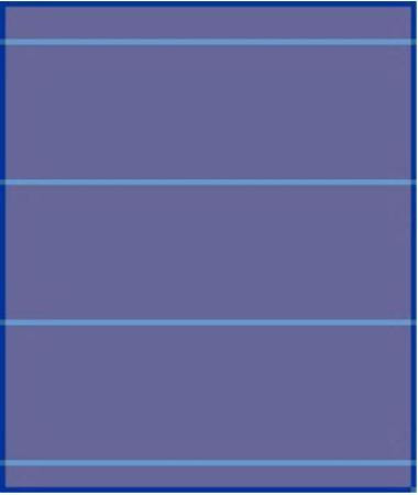 Medline - Spt-Draplgscs - Drape,70X85",Large - Case/100