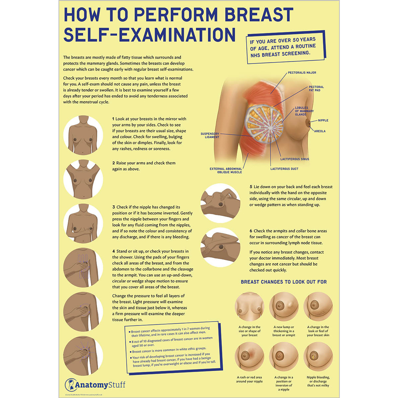 The Female Breast Chart (Laminated)