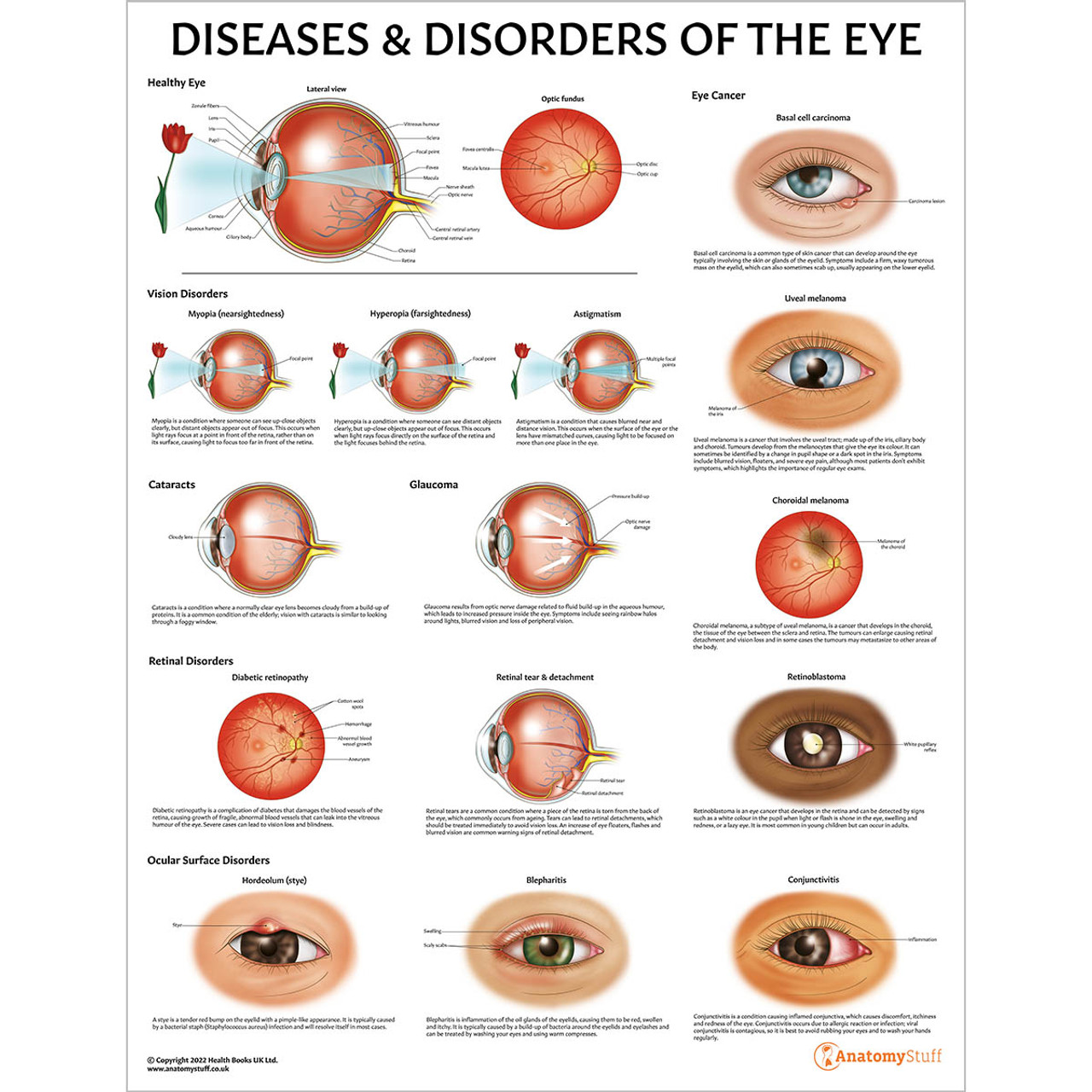 Diseases And Disorders Of The Eye Chartposter Laminated 