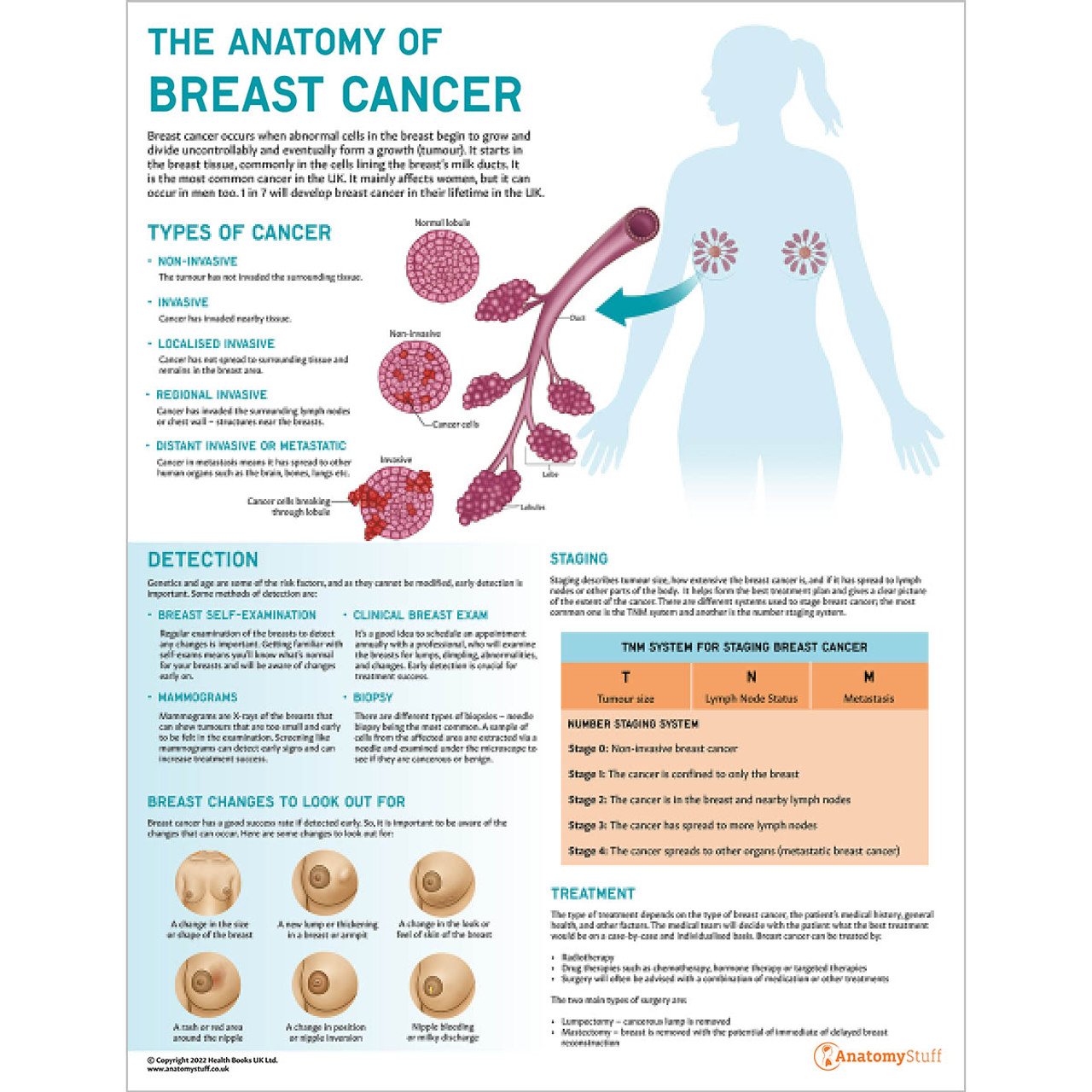 The Anatomy Of Breast Cancer Chart Breast Cancer Awareness Chart Anatomystuff