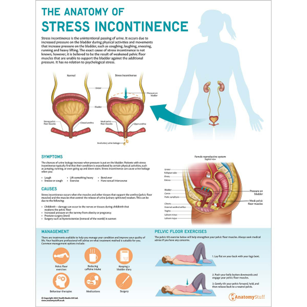 Stress Urinary Incontinence Evaluation and Treatment - YouTube