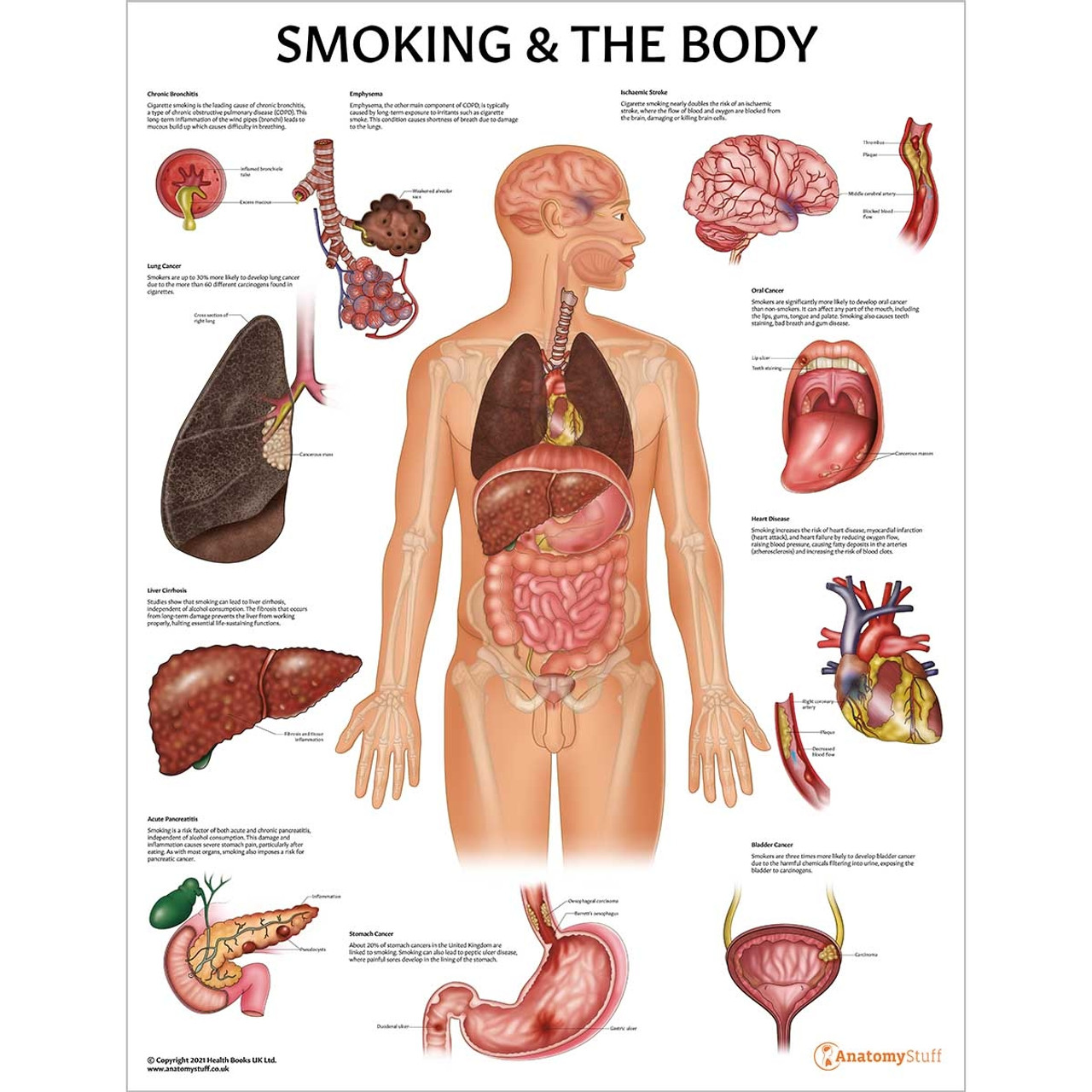 cigarette smoker body