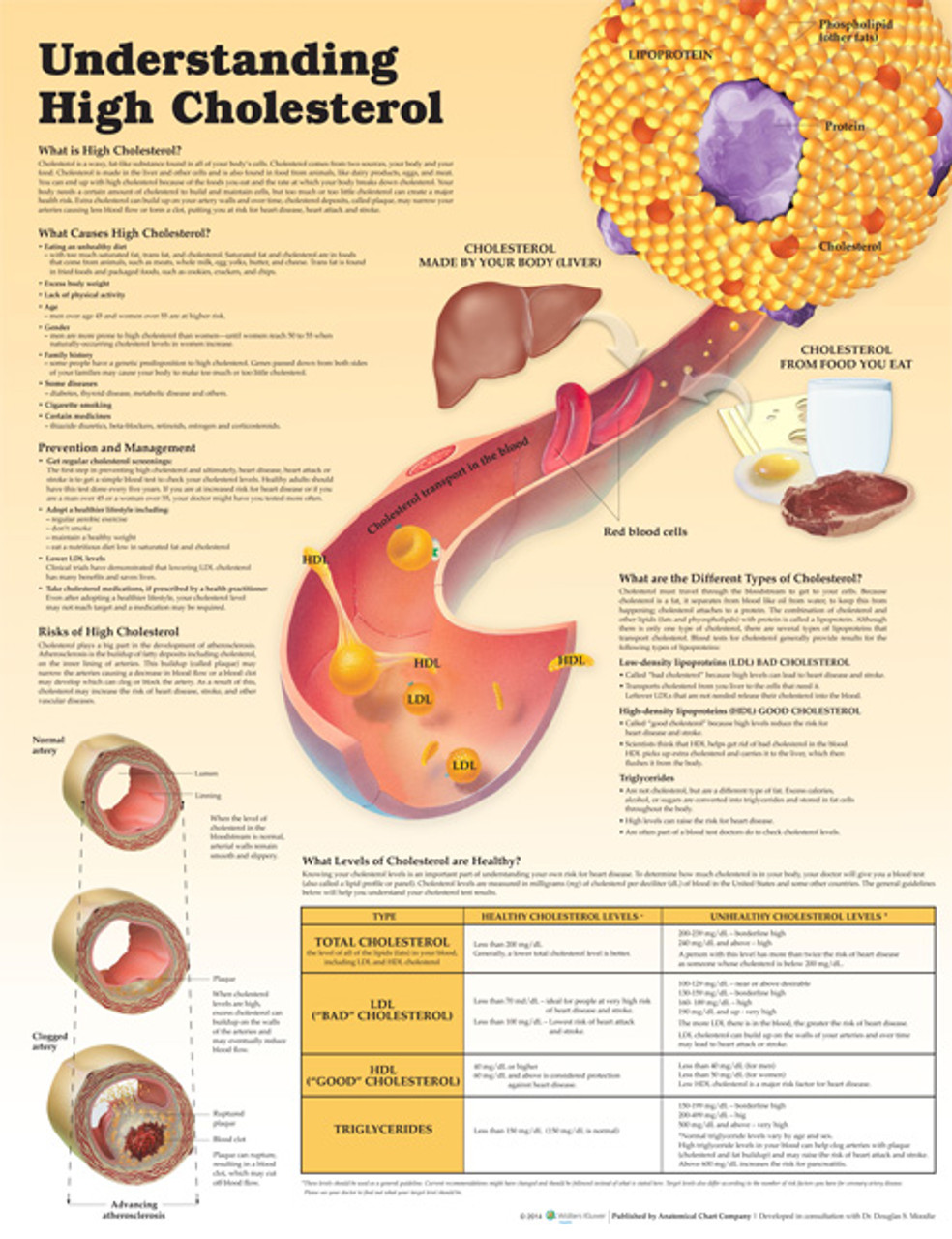 Understanding High Cholesterol Poster Cholesterol Anatomical Chart   9781451193244  74448.1641292409 