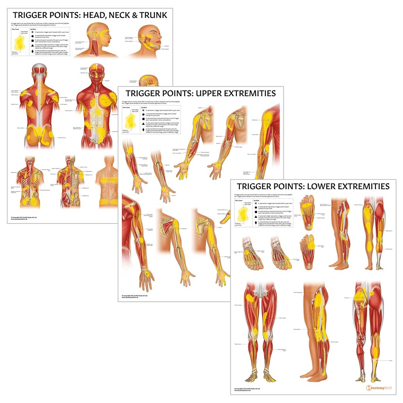 Trigger Points 3 Poster Collection | Myofascial Pain Charts