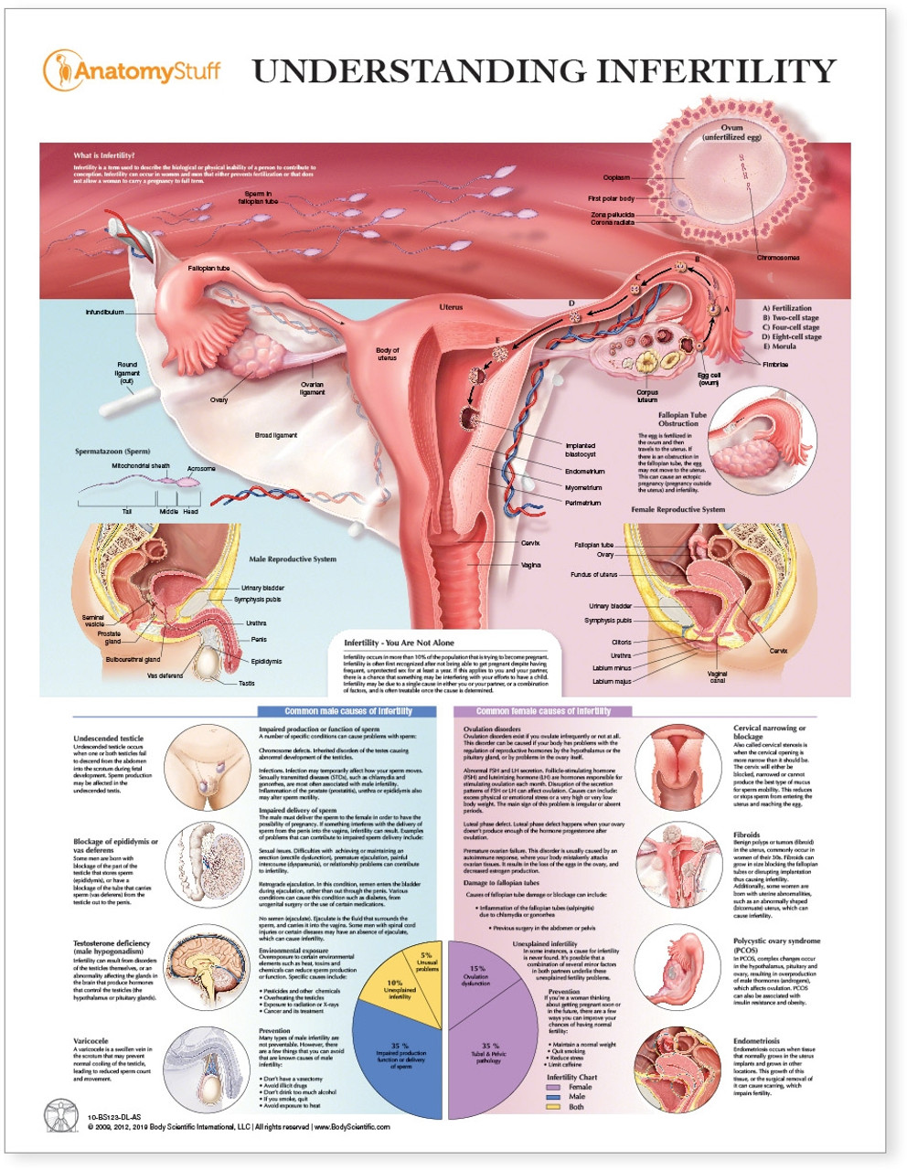 male infertility chart