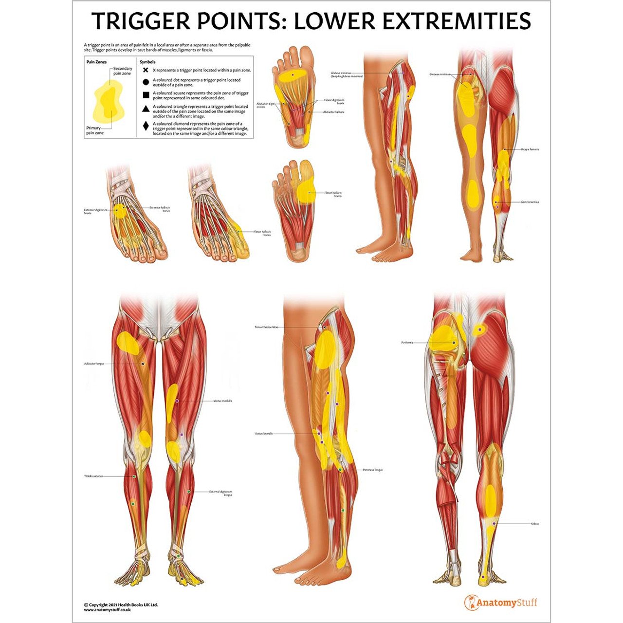 Trigger Points: Lower Extremities