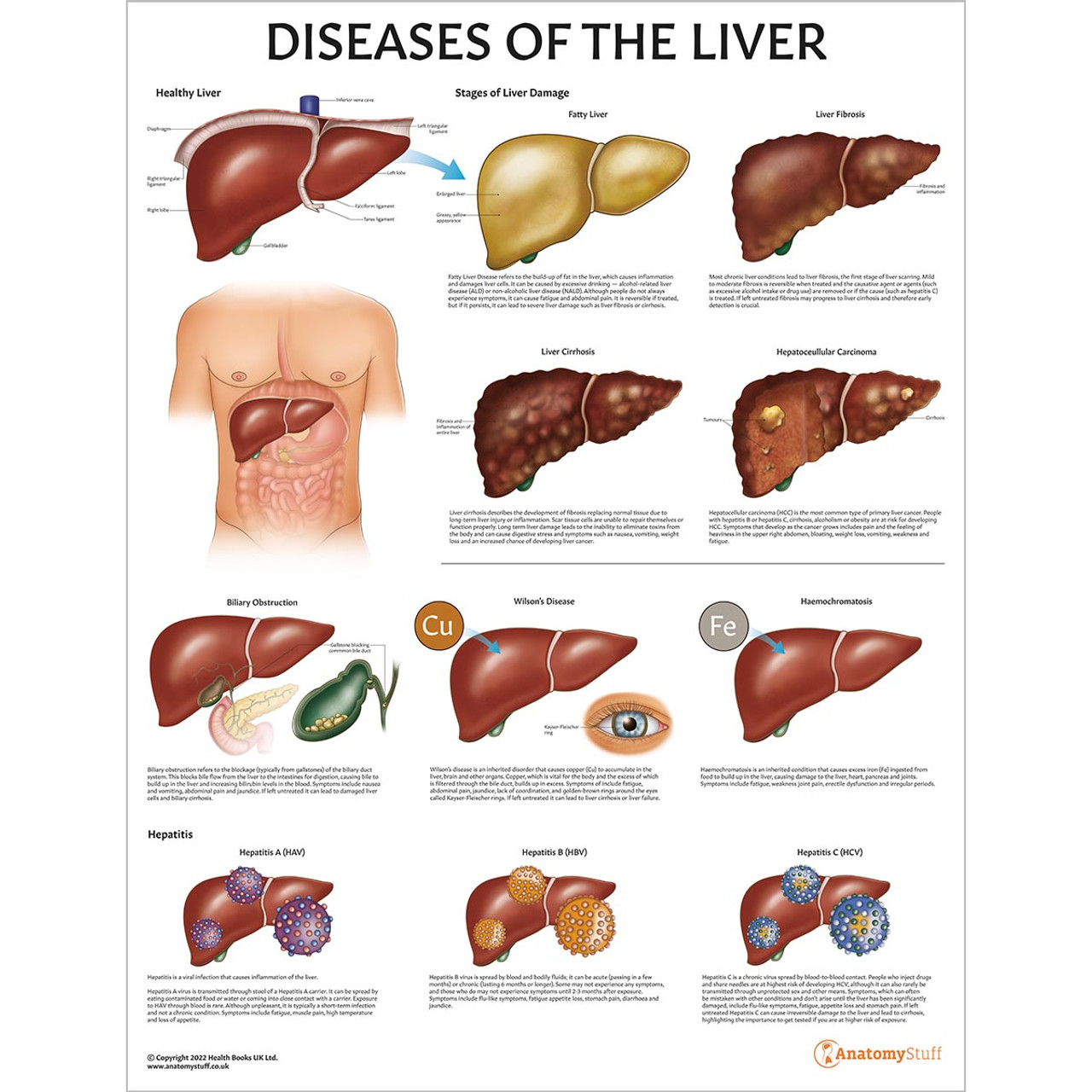 diseases of the liver