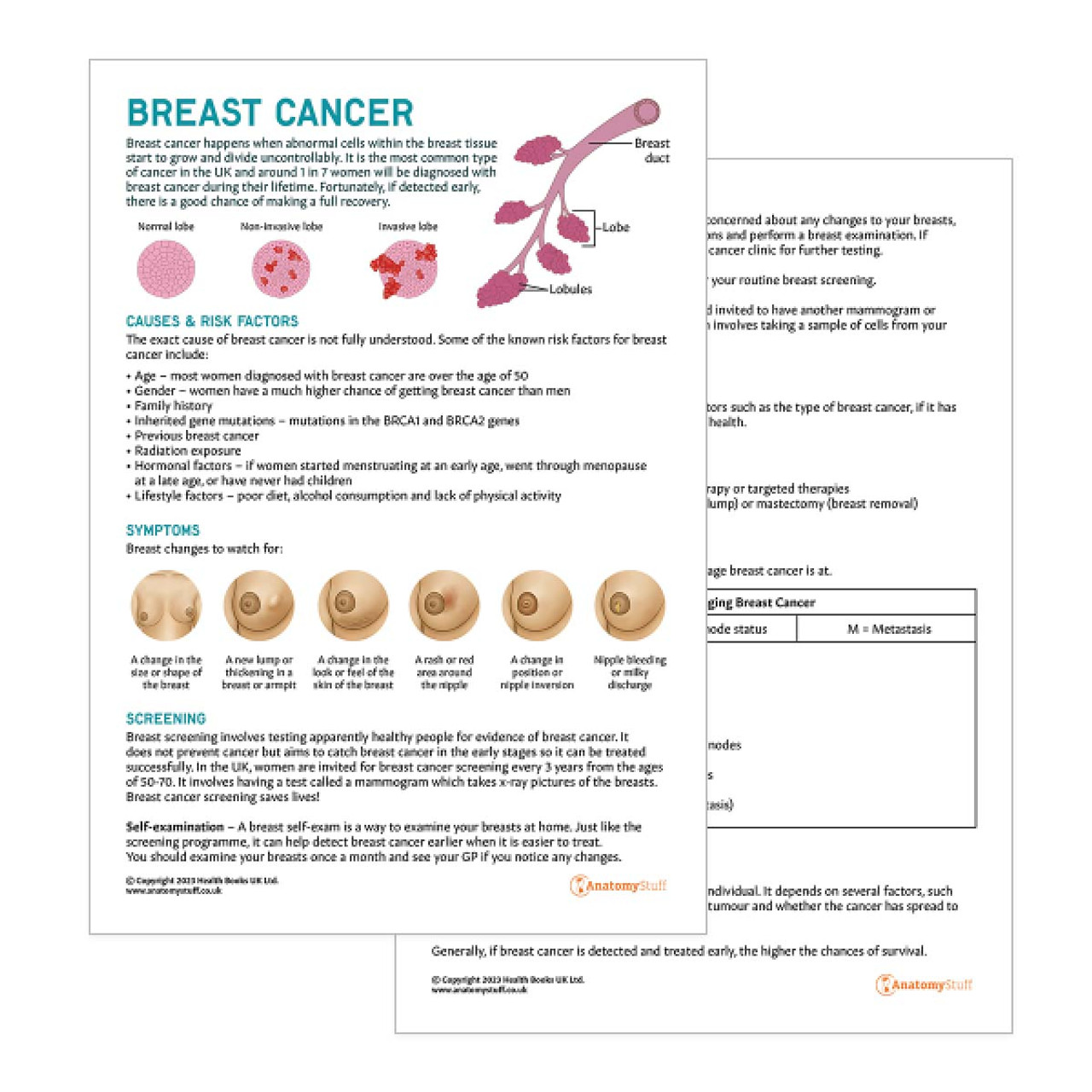 Female Breast Anatomy Chart / Poster Laminated