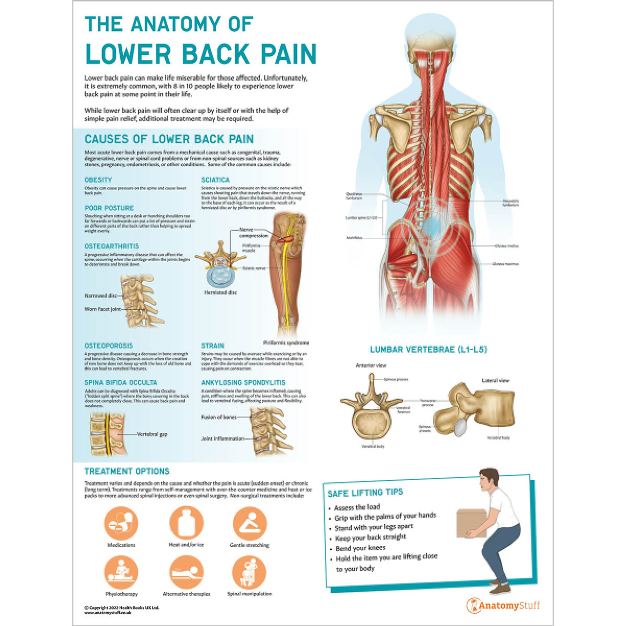 The Anatomy Of Lower Back Pain Chart Poster Laminated lupon.gov.ph
