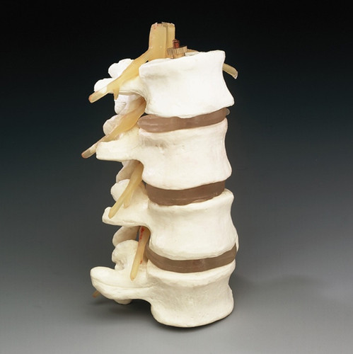 Budget 4-part Lumbar Spine Model