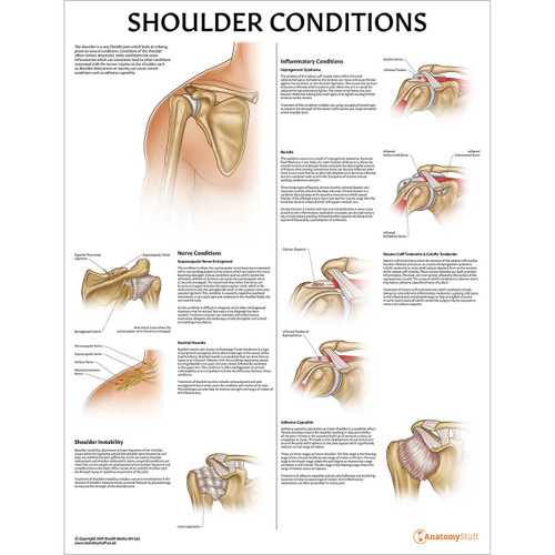 Laminated Shoulder Conditions Chart