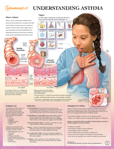 Laminated Understanding Asthma Chart
