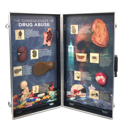 NEW Drug Abuse Consequences 3D Display 78928