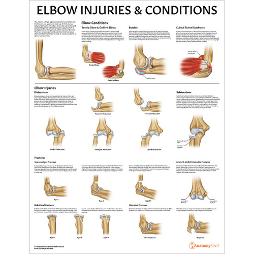 Elbow Injuries and Conditions Chart