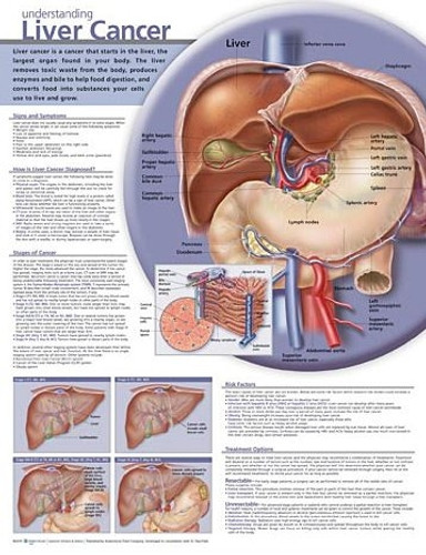 Understanding Liver Cancer Chart