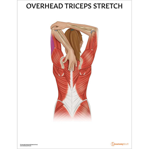 Overhead Triceps Stretch Chart Poster Laminated