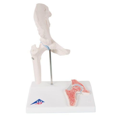 Mini Hip Joint Model with Cross-Section A84/1