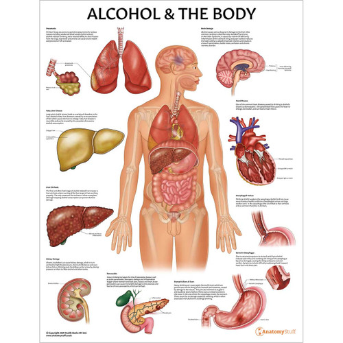 Laminated Alcohol & the Body Chart
