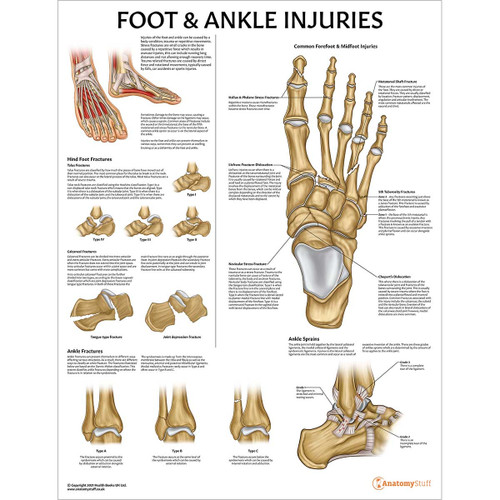 Foot & Ankle Injuries Chart / Poster - Laminated