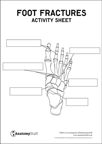 Foot Fractures Activity Sheet PDF