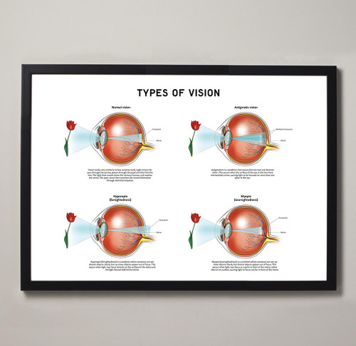 Framed Types of Vision Print