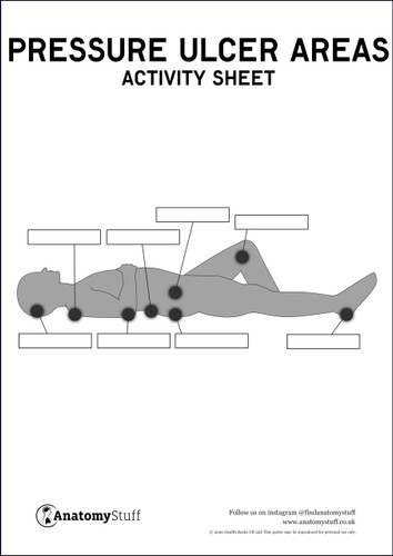 Activity Sheet Pressure Ulcer Areas