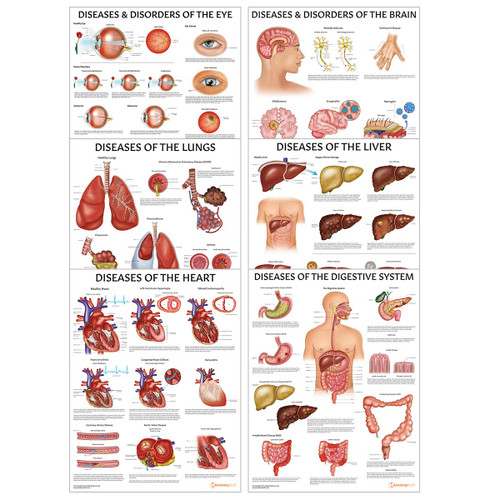 Organ Pathology 6 Poster Collection Bundle