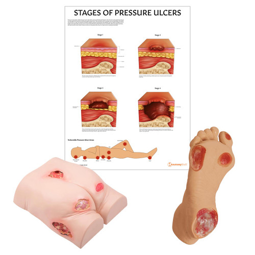 Pressure Ulcer Collection