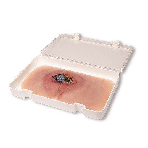 Wound Moulage Sacral Decubitus (Untreated) - PW001A