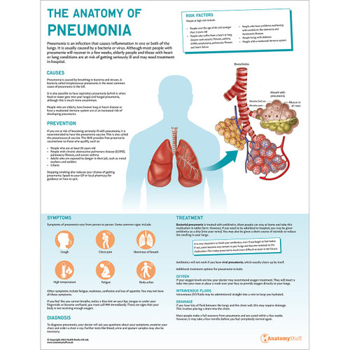 The Anatomy of Pneumonia Poster