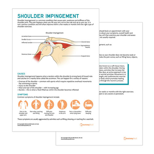 Shoulder Impingement Syndrome Patient Education Handout