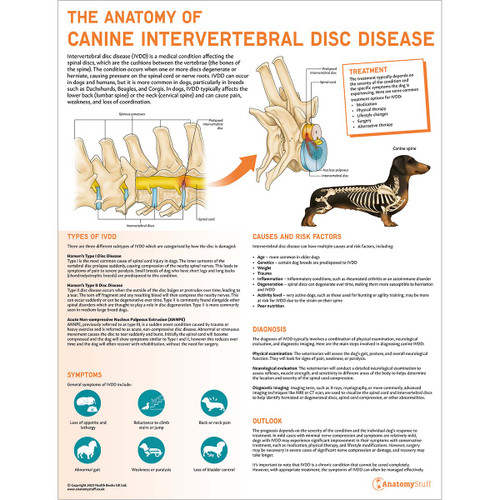 The Anatomy of Intervertebral Disc Disease Chart/Poster