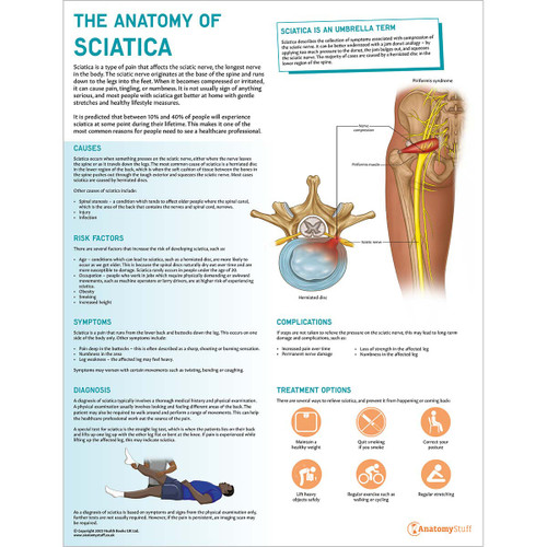 The Anatomy of Sciatica Chart/Poster