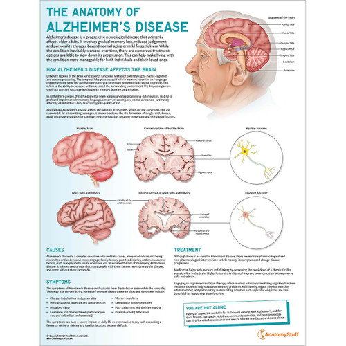The Anatomy of Alzheimer's Disease Chart / Poster - Laminated
