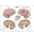 Model shows various pathologies such as Alzheimer's, tumours, MS, Parkinson's disease and stroke