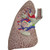Diseased Lung Model (COPD, Cancer, Asthma)
