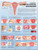 Common Gynaecological Disorders Chart / Poster - Laminated