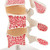 Osteoporosis Model (3 Vertebrae)