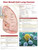 Non-Small Cell Lung Cancer Chart / Poster - Laminated